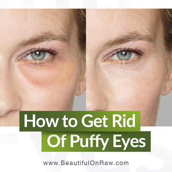 Eye Bags and Puffiness: Get Rid of Puffy Eyes